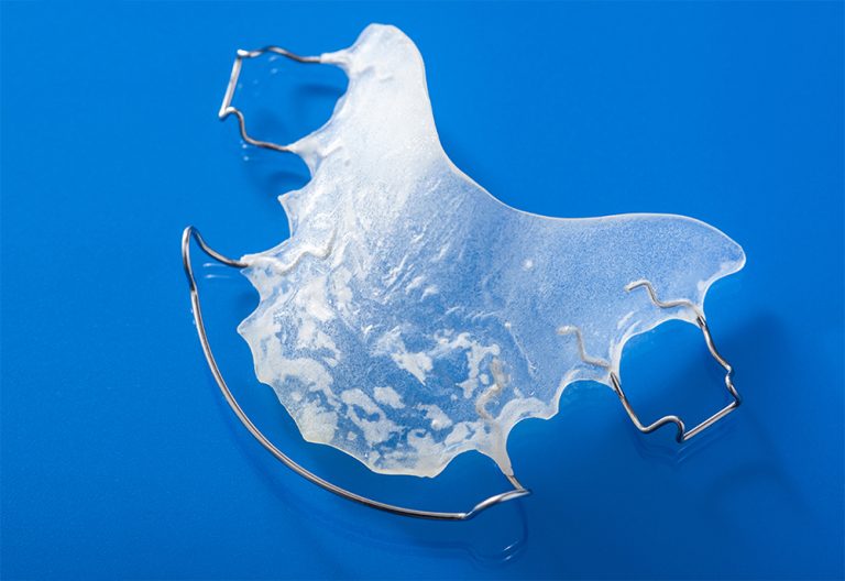 Retainers in Oakdale, CA | Protect the Smile You Earned